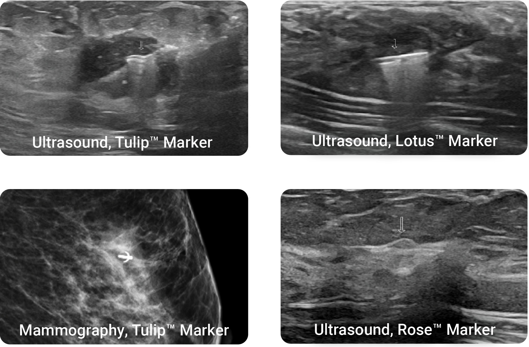 LumiMARK marker shapes Tulip, Lotus, and Rose under ultrasound and mammography